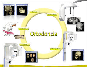 Dentista Sinagra - Genova - Impianti - Cure dentali - Denti - Otturazioni - Implantologia - Paradontologia - Carie